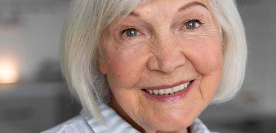 Metal-Based-Dentures