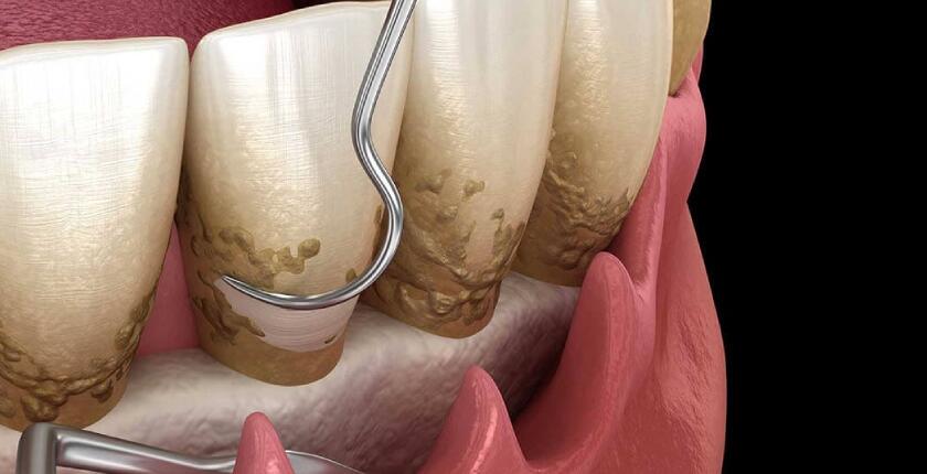 Periodontology