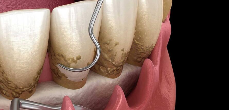 Periodontology