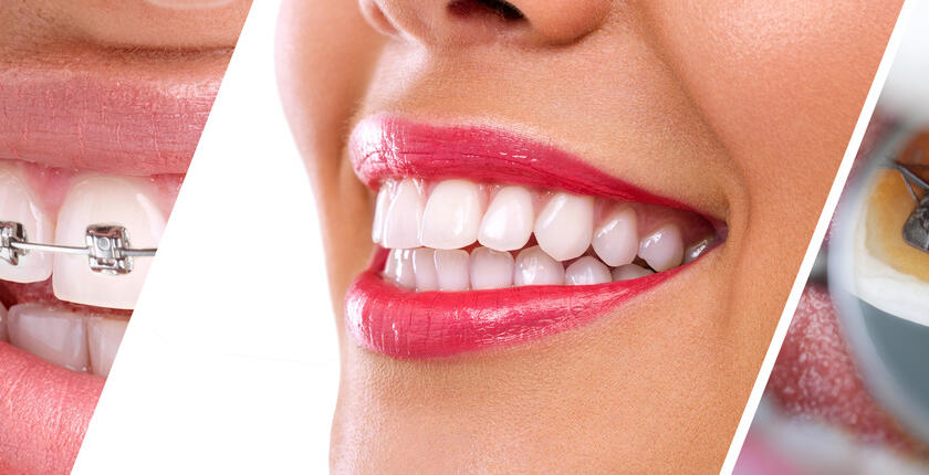 Treatment-for-Crooked-Teeth