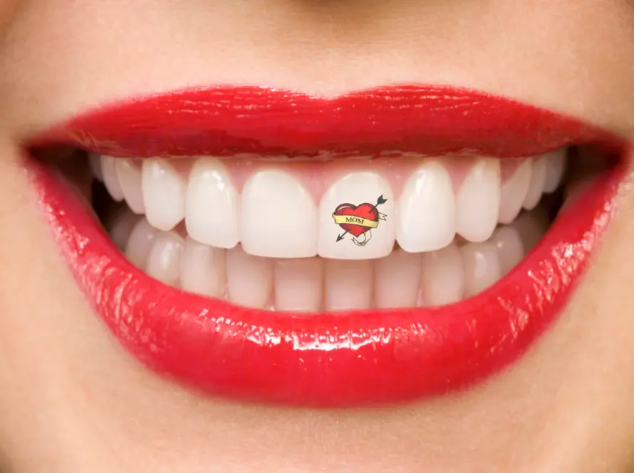 What-is-Dental-Tattoo
