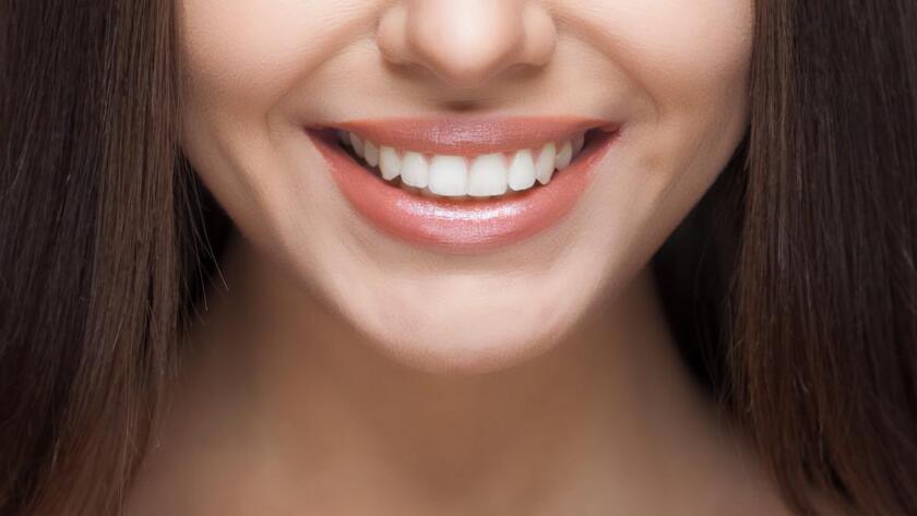 Hollywood smile achieved at Antalya Smile Designs Dental Clinic in Antalya, Turkey