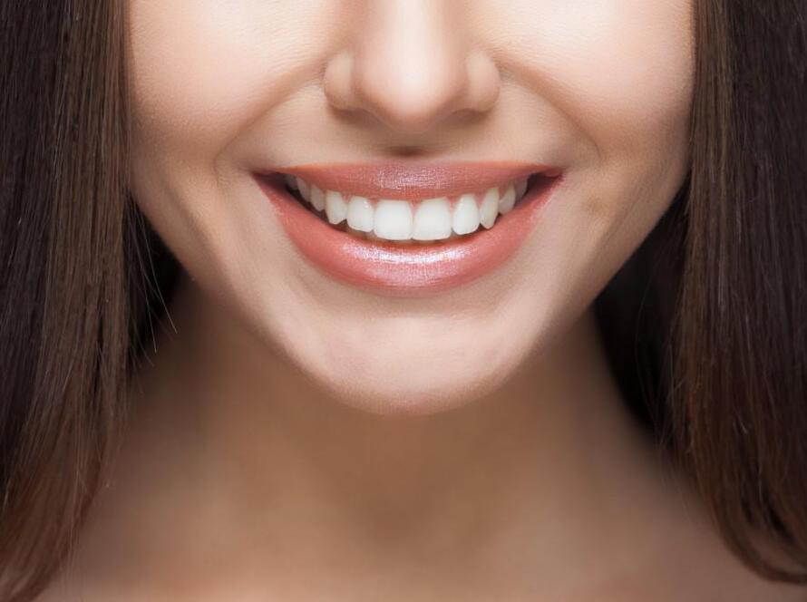 Hollywood smile achieved at Antalya Smile Designs Dental Clinic in Antalya, Turkey