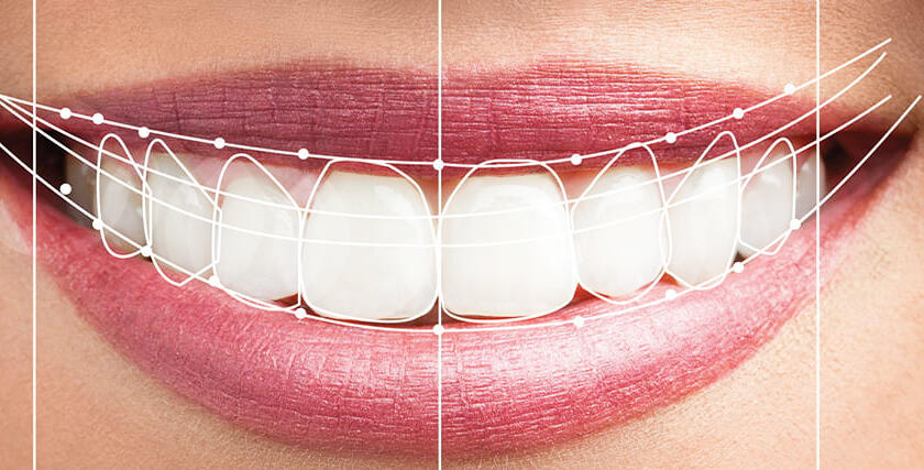 What-is-Smile-Design-2