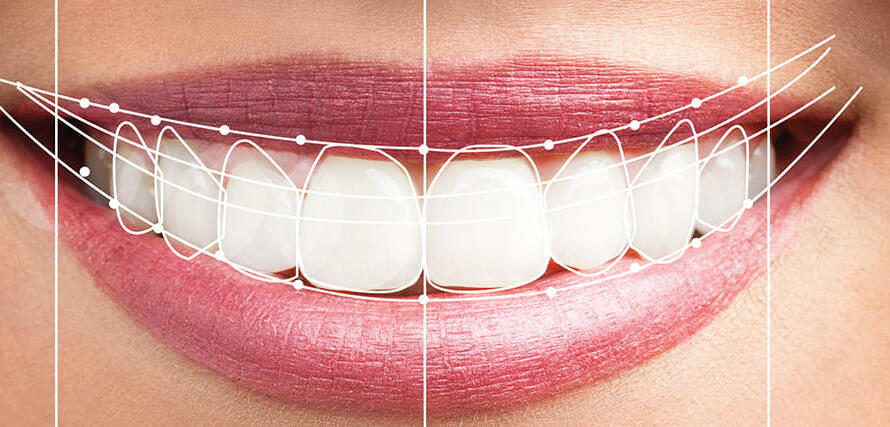 What-is-Smile-Design-2