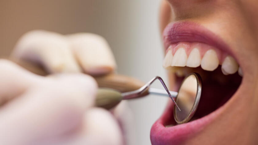 Comparison of Zirconium and E-Max veneers at Antalya Smile Designs Dental Clinic